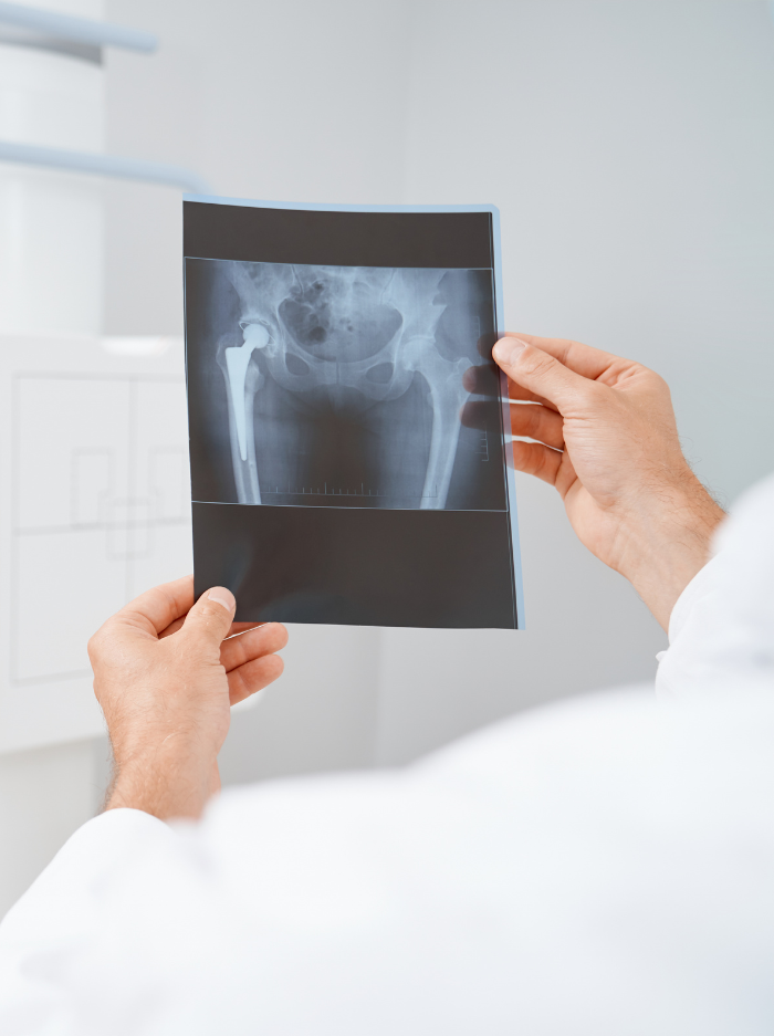 Profissional de saúde a segurar radiografia para recolha e reciclagem